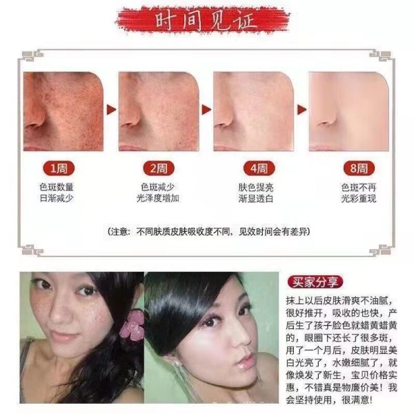 Genuine whitening and freckle removing cream - Image 7